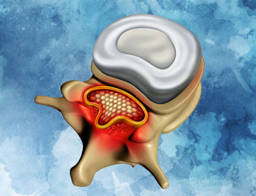 Spinal Stenosis