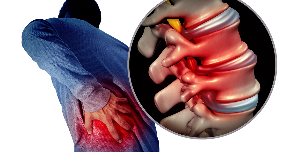 Alternative Treatments to Back Pain