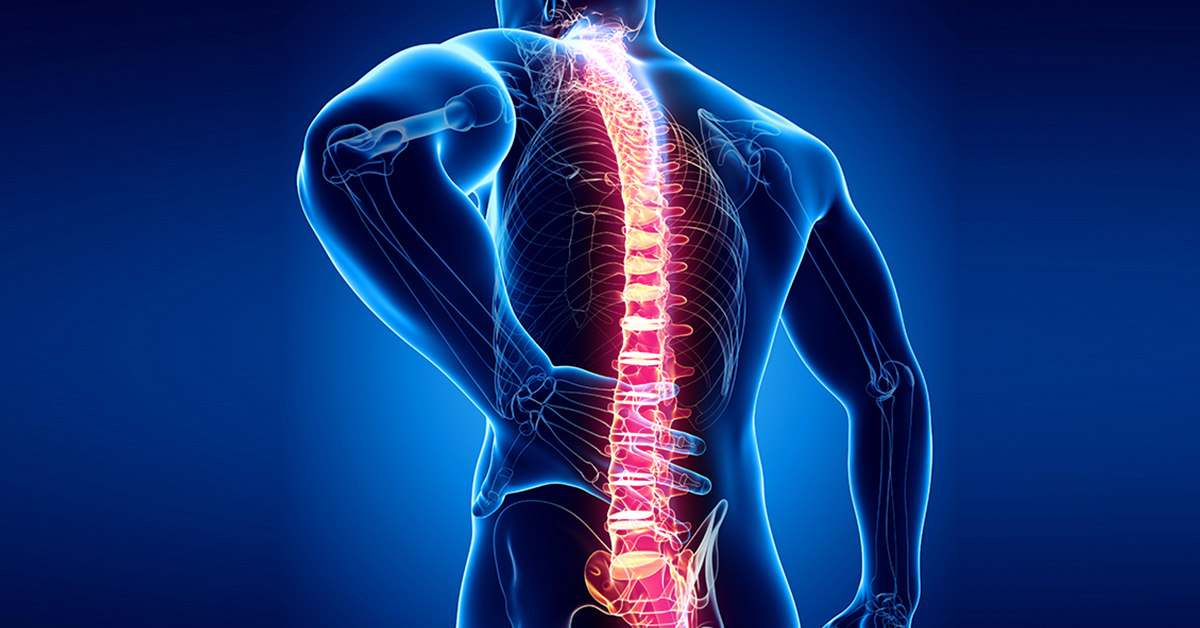 Anterior Lumbar Interbody Fusion