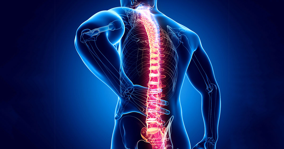 Facet Joint Arthritis