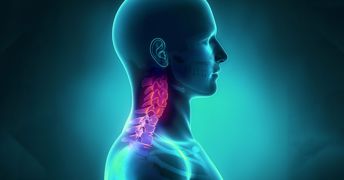 Fractures of the Neck