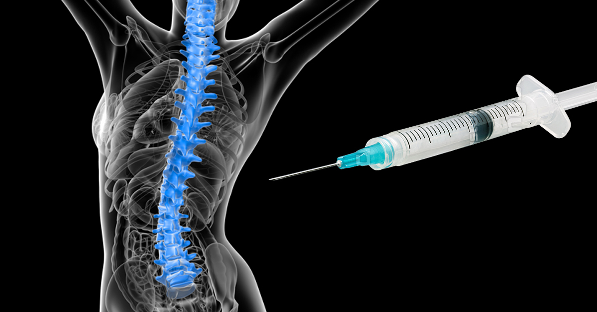 Neurolytic Lumbar Facet Block