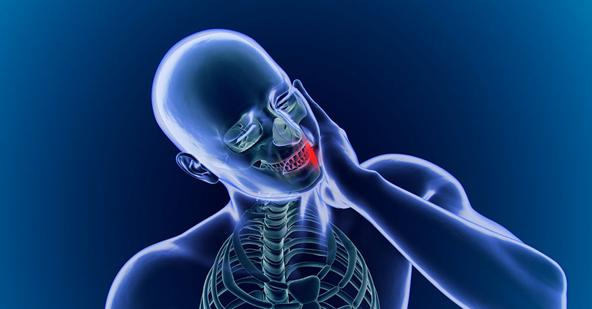 Trigeminal Neuralgia
