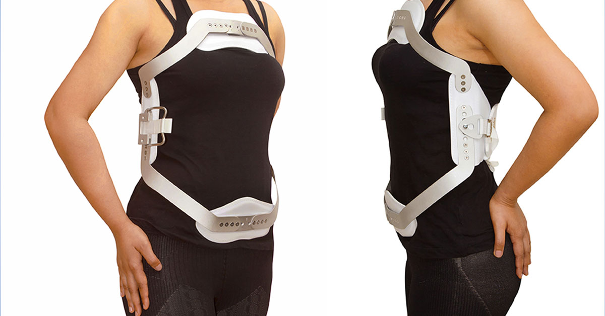 Scoliosis Bracing