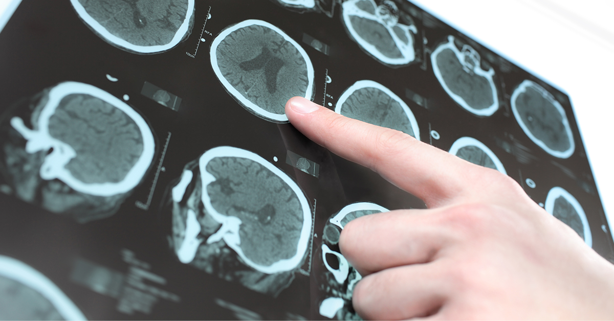 what is a neurosurgeon